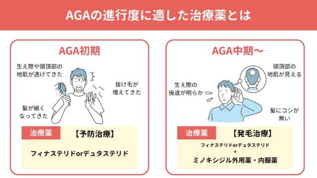 AGAの進行に合わせた治療薬