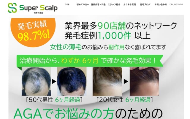 スーパースカルプ発毛センター岐阜可児店公式サイト