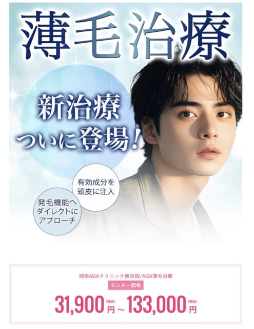 湘南美容クリニックのAGA治療モニター募集の画像