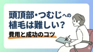 頭頂部・つむじへの植毛は難しい?費用と成功のコツ