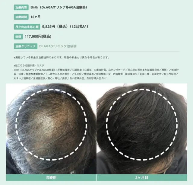 Dr.AGAクリニックのクーポン・割引情報まとめ｜初月980円から | ZERO