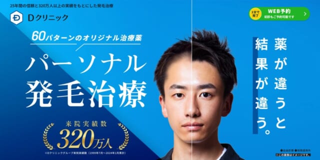 Dクリニックの発毛治療 公式LP
