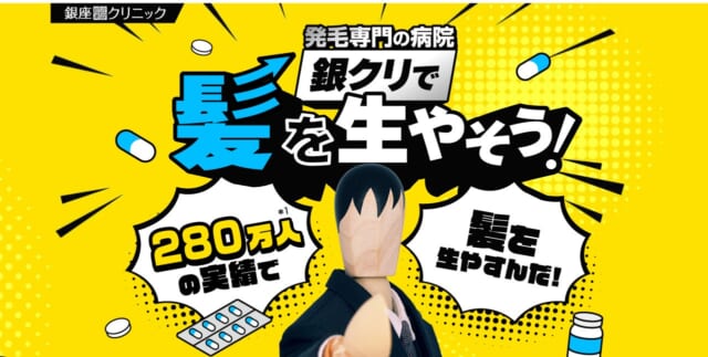 銀座総合美容クリニックのAGA治療 公式LP